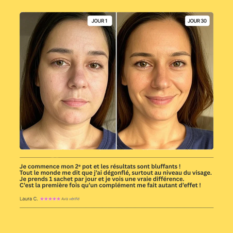 Gummies Ashwagandha cortisol